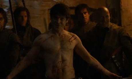 Game Of Thrones - Ramsay Bolton